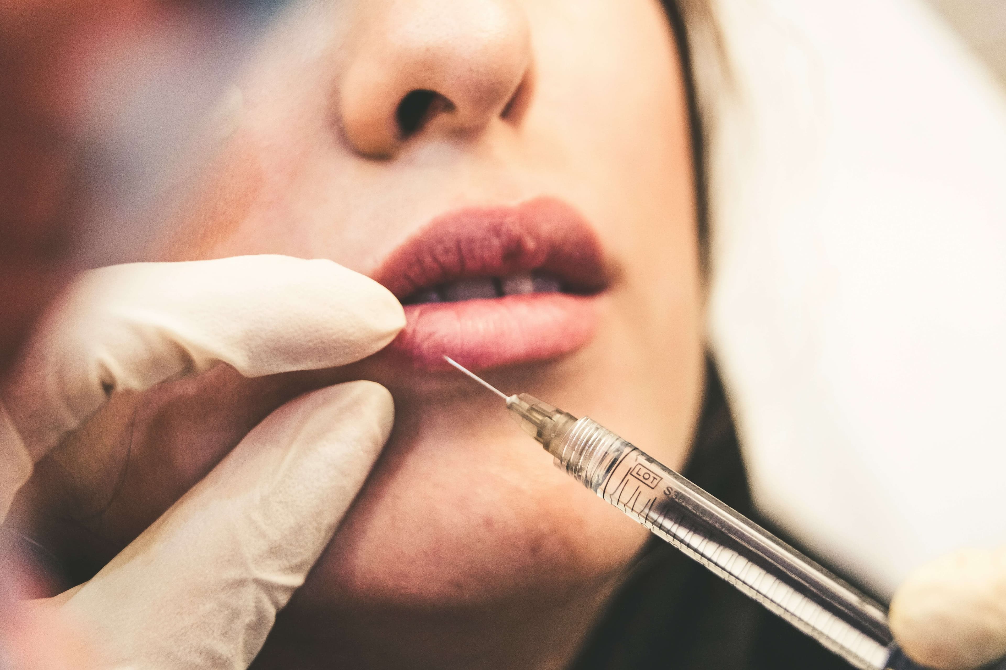 Important Factors to Consider Before Undergoing a Cosmetic Procedure